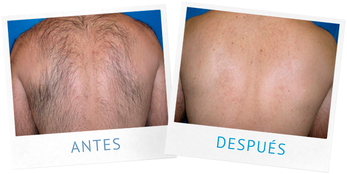 Resultados: Después de 6 sesiones